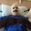 فریبرز لاچینی در حادثه آتش‌سوزی دچار سوختگی شد